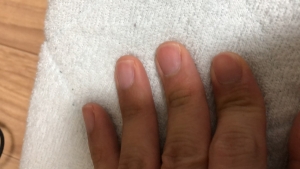 ツメ手入れ後の状態